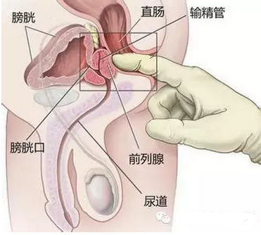 前列腺