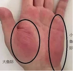 肺不好，脸唇必暗黑