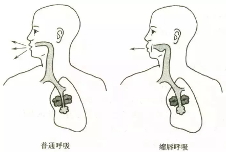 脊柱侧弯的自我康复方法